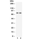 Western blot testing of mouse 1) kidney and 2) NIH3T3 lysate with ZBTB7A antibody. Predicted molecular weight ~61 kDa but routinely observed at ~75 kDa.