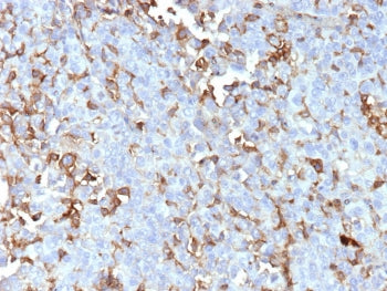 IHC staining of FFPE human adrenal gland tissue with Periostin antibody (clone POSTN/4095). HIER: boil tissue sections in pH 9 10mM Tris with 1mM EDTA for 20 min and allow to cool before testing.