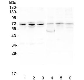 Western blot testing of 1) human PC-3, 2) human A549, 3) human HepG2, 4) rat ovary, 5) rat lung and 6) rat testis lysate with ARNTL2 antibody at 0.5ug/ml. Predicted molecular weight ~71 kDa.