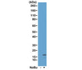 Western blot of acid extracts from HeLa cells untreated (-) or treated (+) with sodium butyrate using recombinant H3K18ac antibody at 0.5 ug/mL showed a band of Histone H3 acetylated at Lysine 18 in treated HeLa cells.