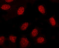 Immunofluorescent staining of FFPE human U-2 OS cells with MINDY3 antibody (red). HIER: steam section in pH6 citrate buffer for 20 min.