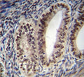 Progesterone Receptor antibody immunohistochemistry analysis in formalin fixed and paraffin embedded human uterus tissue.