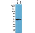 Western blot of human MCF7 and HeLa cell lysate using recombinant Cytokeratin 18 antibody at 1:1000. Predicted molecular weight ~48 kDa.