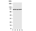 Western blot testing of STAT1 antibody and Lane 1: MM451; 2: HeLa; 3: HT1080; 4: SW620; 5: Jurkat cell lysate. Predicted molecular weight: ~91/84 kDa (alpha/beta).
