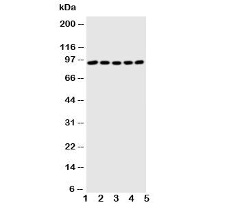 Western blot testing of STAT1 antibody and Lane 1: MM451; 2: HeLa; 3: HT1080; 4: SW620; 5: Jurkat cell lysate. Predicted molecular weight: ~91/84 kDa (alpha/beta).