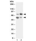 Western blot testing of human 1) SKOV3 and 2) HeLa lysate with VNN1 antibody at 0.5ug/ml. Expected molecular weight: ~56 kDa (unmodified) and ~70 kDa (glycosylated).