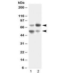 Western blot testing of human 1) SKOV3 and 2) HeLa lysate with VNN1 antibody at 0.5ug/ml. Expected molecular weight: ~56 kDa (unmodified) and ~70 kDa (glycosylated).