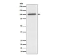 Western blot testing of human A431 cell lysate with ACTN4 antibody. Predicted molecular weight ~105 kDa.