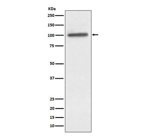 Western blot testing of human A431 cell lysate with ACTN4 antibody. Predicted molecular weight ~105 kDa.
