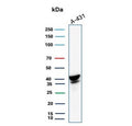 Western blot testing of human A431 cell lysate with SERPINB3 antibody. Predicted molecular weight ~46/39 kDa (two isoforms).