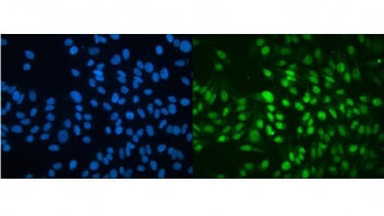 Immunofluorescent staining of FFPE human HeLa cells with MBD4 antibody (green) and DAPI nuclear stain (blue). HIER: steam section in pH6 citrate buffer for 20 min.