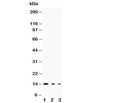 Western blot testing of IL-3 antibody and Lane 1: recombinant mouse protein 10ng; 2: 5ng; 3: 2.5ng