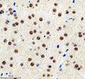 Immunohistochemical staining of BCLAF1 using anti-BCLAF1 antibody. BCLAF1 was detected in a paraffin-embedded section of mouse brain tissue. Heat mediated antigen retrieval was performed in EDTA buffer (pH 8.0, epitope retrieval solution). The tissue section was blocked with 10% goat serum. The tissue section was then incubated with 2 ug/ml rabbit anti-BCLAF1 antibody overnight at 4oC. Peroxidase Conjugated Goat Anti-rabbit IgG was used as secondary antibody and incubated for 30 min at 37oC.