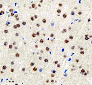 Immunohistochemical staining of BCLAF1 using anti-BCLAF1 antibody. BCLAF1 was detected in a paraffin-embedded section of mouse brain tissue. Heat mediated antigen retrieval was performed in EDTA buffer (pH 8.0, epitope retrieval solution). The tissue section was blocked with 10% goat serum. The tissue section was then incubated with 2 ug/ml rabbit anti-BCLAF1 antibody overnight at 4oC. Peroxidase Conjugated Goat Anti-rabbit IgG was used as secondary antibody and incubated for 30 min at 37oC.