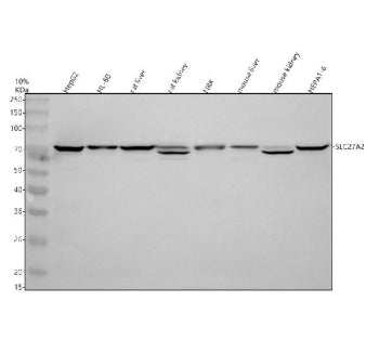 Western blot analysis of SLC27A2 using anti-SLC27A2 antibody. Electrophoresis was performed on a 10% SDS-PAGE gel at 80V (Stacking gel) / 120V (Resolving gel) for 2 hours. Lane 1: human HepG2 whole cell lysates, Lane 2: human HL-60 whole cell lysates, Lane 3: rat liver tissue lysates, Lane 4: rat kidney tissue lysates, Lane 5: rat NRK whole cell lysates, Lane 6: mouse liver tissue lysates Lane 7: mouse kidney tissue lysates, Lane 8: mouse HEPA1-6 whole cell lysates.