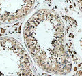 Immunohistochemical staining of SKA3 using anti-SKA3 antibody. SKA3 was detected in a paraffin-embedded section of human testis tissue. Heat mediated antigen retrieval was performed in EDTA buffer (pH 8.0, epitope retrieval solution). The tissue section was blocked with 10% goat serum. The tissue section was then incubated with 2 ug/ml rabbit anti-SKA3 antibody overnight at 4oC. Peroxidase Conjugated Goat Anti-rabbit IgG was used as secondary antibody and incubated for 30 min at 37oC.