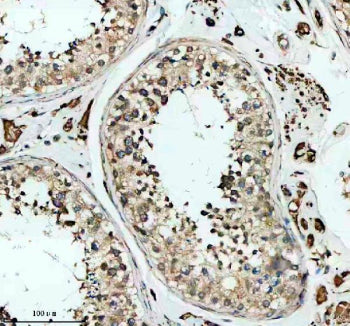 Immunohistochemical staining of SKA3 using anti-SKA3 antibody. SKA3 was detected in a paraffin-embedded section of human testis tissue. Heat mediated antigen retrieval was performed in EDTA buffer (pH 8.0, epitope retrieval solution). The tissue section was blocked with 10% goat serum. The tissue section was then incubated with 2 ug/ml rabbit anti-SKA3 antibody overnight at 4oC. Peroxidase Conjugated Goat Anti-rabbit IgG was used as secondary antibody and incubated for 30 min at 37oC.