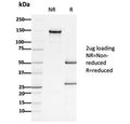 SDS-PAGE analysis of purified, BSA-free Adenomatous polyposis coli antibody (clone ALi 12-28) as confirmation of integrity and purity.
