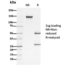 SDS-PAGE analysis of purified, BSA-free Adenomatous polyposis coli antibody (clone ALi 12-28) as confirmation of integrity and purity.