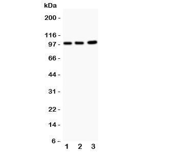 Western blot testing of EPB41L1 antibody and Lane 1: rat brain; 2: mouse brain; 3: human A549. Predicted/observed size ~99 kDa.