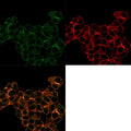 Immunofluorescent staining of PFA-fixed human MCF-7 cells with Lactotransferrin antibody (Green, clone LTF/4074); Red = Phalloidin; Yellow-Brown = superimposed.