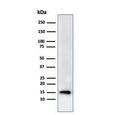 Western blot testing of human HeLa cell lysate using recombinant FABP5 antibody (clone rFABP5/6354). Predicted molecular weight ~15 kDa.