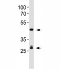 Western blot analysis of lysate from mouse liver tissue lysate using Shh antibody. Predicted molecular weight: 45/27/19 kDa (1)