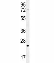 H-RAS antibody western blot analysis in mouse cerebellum tissue lysate. Predicted molecular weight ~ 21 kDa.
