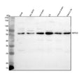 Western blot analysis of NETO2 using anti-NETO2 antibody. Lane 1: human SIHA whole cell lysates, Lane 2: human SH-SY5Y whole cell lysates, Lane 3: rat brain tissue lysates, Lane 4: rat C6 whole cell lysates, Lane 5: mouse brain tissue lysates, Lane 6: mouse Neuro-2a whole cell lysates. After electrophoresis, proteins were transferred to a nitrocellulose membrane at 150 mA for 50-90 min. Blocked the membrane with 5% non-fat milk/TBS for 1.5 hour at RT.