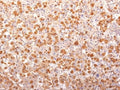 IHC testing of FFPE human pituitary gland with recombinant ACTH antibody (clone r57). Required HIER: boil tissue sections in 10mM citrate buffer, pH 6, for 10-20 min followed by cooling at RT for 20 min.
