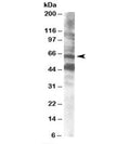 Western blot testing of human brain lysate with CPEB antibody at 0.5ug/ml. Both the expected ~65kDa band and the additional ~48kDa band are blocked by the immunizing peptide.