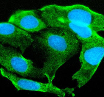 Immunofluorescent staining of STYK1 using anti-STYK1 antibody. STYK1 was detected in an immunocytochemical section of Caco-2 cells. Enzyme antigen retrieval was performed using IHC enzyme antigen retrieval reagent for 15 mins. The cells were blocked with 10% goat serum. And then incubated with 5 ug/ml rabbit anti-STYK1 antibody overnight at 4oC. DyLight 488 Conjugated Goat Anti-Rabbit IgG was used as secondary antibody at 1:500 dilution and incubated for 30 min at 37oC.