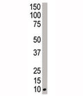 Western blot analysis of NEDD8 antibody and HeLa cell lysate. Predicted molecular weight ~9 kDa.