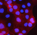 Immunofluorescent staining of STARD10 using anti-STARD10 antibody (red). STARD10 was detected in an immunocytochemical section of CACO-2 cells. Enzyme antigen retrieval was performed using IHC enzyme antigen retrieval reagent for 15 mins. The cells were blocked with 10% goat serum. And then incubated with 5 ug/ml rabbit anti-STARD10 antibody overnight at 4oC. Cy3 Conjugated Goat Anti-Rabbit IgG was used as secondary antibody at 1:500 dilution and incubated for 30 min at 37oC.