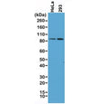 Western blot of human HeLa and 293 cell lysate using recombinant Beta Catenin antibody at 1:400. Predicted molecular weight ~85 kDa, but routinely observed at 90-95 kDa.