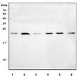 Western blot testing of 1) human A549, 2) human SiHa, 3) human ThP-1, 4) human U-251, 5) rat testis and 6) mouse testis tissue lysate with MSRB3 antibody. Predicted molecular weight ~21 kDa.