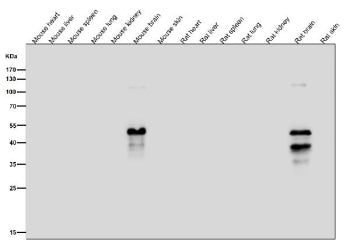 All lanes use the Phospho-MAP2 (Ser136) antibody at 1:1K dilution for 1 hour at room temperature. Phospho-MAP2 (Ser136) signal was detected only in brain lysates, consistent with MAP2 being a neuron-specific protein that is naturally phosphorylated in neural tissue and absent from non-neural organs such as liver, spleen, lung, kidney, and skin.