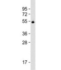Western blot testing of human plasma lysate with Vitamin D binding protein antibody at 1:2000. Predicted molecular weight: 53 kDa.