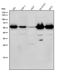 Western blot testing of human samples using the Phospho-Beta Arrestin 1 (Ser412) antibody at 1:1000 dilution for 1 hour at room temperature. Western blot analysis of phospho-beta-arrestin 1 (Ser412) shows a dominant band at ~55 kDa and a secondary band near ~37 kDa across multiple cell lines. Although the predicted size of beta-arrestin 1 is ~47 kDa, phosphorylation at Ser412 causes an upward mobility shift, while the lower band likely represents a truncated or partially degraded form of the protein.