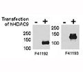 HDAC9 antibody <a href=../tds/hdac9-antibody-f41192>NSJ# F41192</a> and NSJ# F41193 were tested by WB and IP-WB using HeLa and HeLa-HDAC9 transfected cells. Both antibodies detect the protein in transfected cells but not non-transfected.