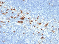 IHC testing of FFPE human tonsil with CD103 antibody (clone ITGAE/2474). HIER: boil tissue sections in pH9, 1mM EDTA buffer, for 10-20 min followed by cooling at RT for 20 min.