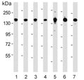 Western blot testing of 1) human PANC-1, 2) human HeLa, 3) human Jurkat, 4) mouse NIH 3T3, 5) human H-4-II-E, 6) human A431 and 7) human HepG2 cell lysate with Splicing factor 3B subunit 1 antibody. Predicted molecular weight ~146 kDa.
