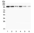 Western blot testing of 1) rat testis, 2) rat thymus, 3) rat spleen, 4) rat lung, 5) mouse testis and 6) mouse thymus lysate with Plasminogen antibody. Predicted molecular weight ~92 kDa, may be observed at higher molecular weights due to glycosylation.