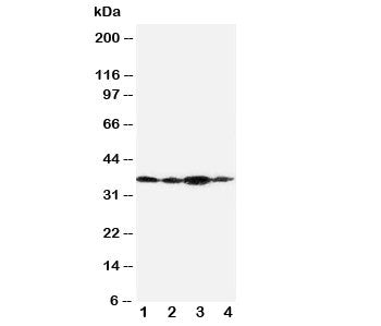 Western blot testing of Podoplanin antibody and Lane 1: SMMC-7721; 2: 293T; 3: HeLa. Predicted molecular weight ~25/36kDa (unmodified/glycosylated).