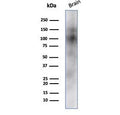 Western blot testing of human brain tissue lysate with CD56 antibody (clone NCAM/7523). Predicted molecular weight: ~110 kDa (soluble fragment), ~120/125 kDa (GPI-anchored), 140/180 kDa (transmembrane isoforms).
