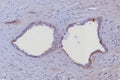 IHC staining of FFPE human prostate tissue with Cytokeratin 6 antibody (clone KRT6/8198R). HIER: boil tissue sections in pH 9 10mM Tris with 1mM EDTA for 20 min and allow to cool before testing.