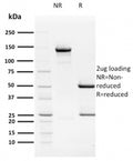 SDS-PAGE analysis of purified, BSA-free HPV16 E2 antibody (TVG 261) as confirmation of integrity and purity.