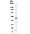 Western blot testing of human cerebellum lysate with Laforin antibody at 0.1ug/ml. Predicted molecular weight: ~37kDa.