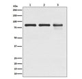 Western blot testing of 1) human A431, 2) mouse NIH3T3 and 3) rat C6 cell lysate with Gamma Catenin antibody. Predicted molecular weight ~86 kDa.