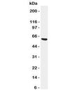 Western blot testing of SERPINA3 antibody and SMMC-7721 cell lysate. Predicted molecular weight: 47/65kDa (unmodified/glycosylated).